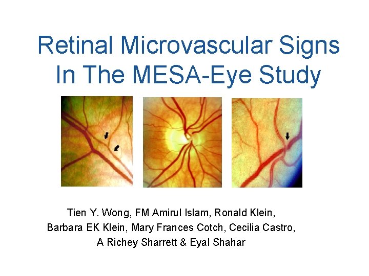 Retinal Microvascular Signs In The MESA-Eye Study Tien Y. Wong, FM Amirul Islam, Ronald