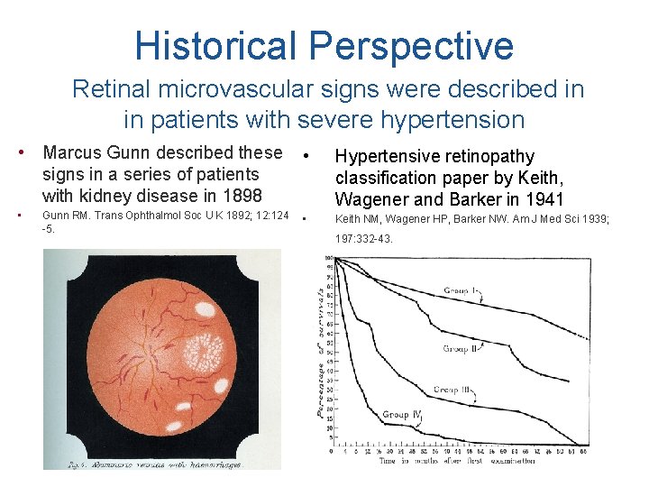 Historical Perspective Retinal microvascular signs were described in in patients with severe hypertension •