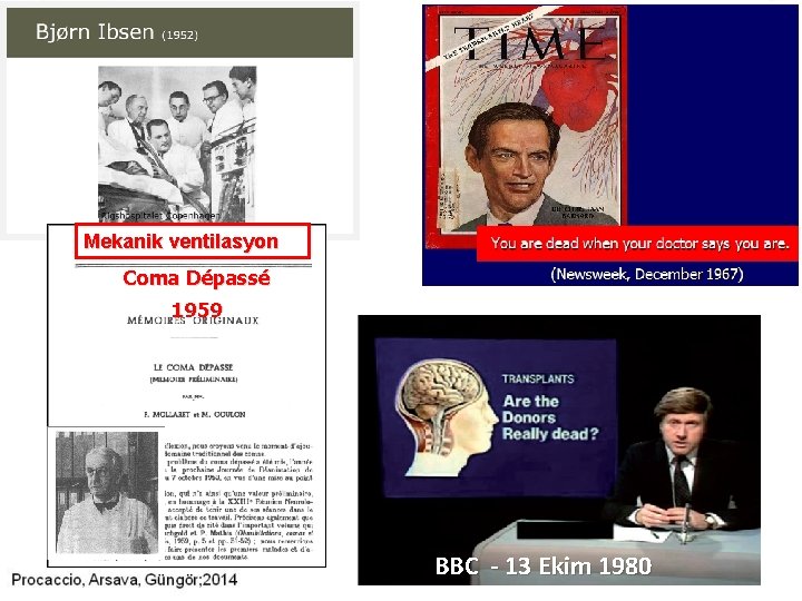 Mekanik ventilasyon Coma Dépassé 1959 BBC - 13 Ekim 1980 Mekanik ventilasyon Coma Dépassé 1959 BBC - 13 Ekim 1980