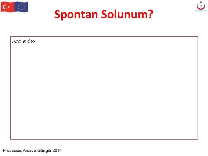 Spontan Solunum? add video Spontan Solunum? add video