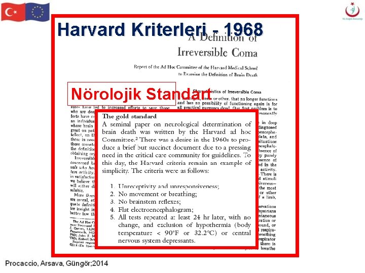 Harvard Kriterleri - 1968 Nörolojik Standart Harvard Kriterleri - 1968 Nörolojik Standart