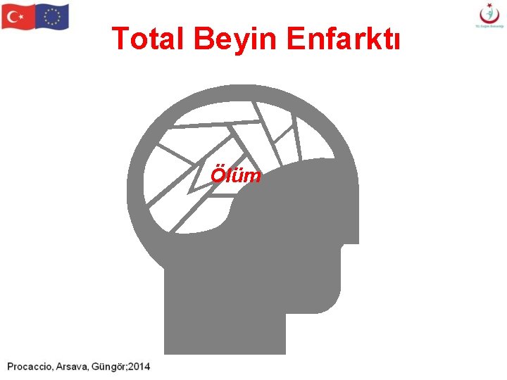 Total Beyin Enfarktı Ölüm Total Beyin Enfarktı Ölüm