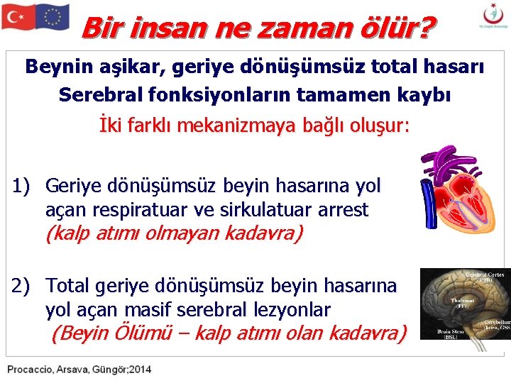 Bir insan ne zaman ölür? Beynin aşikar, geriye dönüşümsüz total hasarı Serebral fonksiyonların tamamen Bir insan ne zaman ölür? Beynin aşikar, geriye dönüşümsüz total hasarı Serebral fonksiyonların tamamen