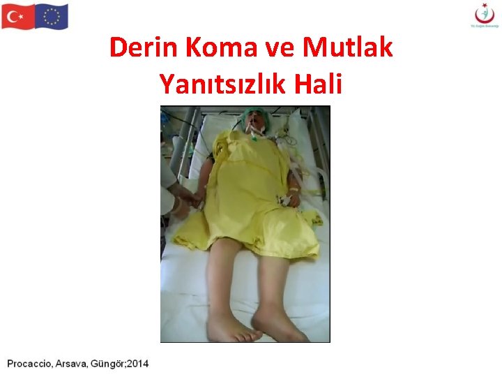 Derin Koma ve Mutlak Yanıtsızlık Hali Derin Koma ve Mutlak Yanıtsızlık Hali