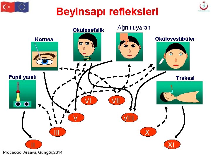 Beyinsapı refleksleri Okülosefalik Ağrılı uyaran Okülovestibüler Kornea Pupil yanıtı Trakeal VI V III II Beyinsapı refleksleri Okülosefalik Ağrılı uyaran Okülovestibüler Kornea Pupil yanıtı Trakeal VI V III II