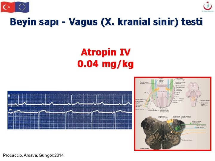 Beyin sapı - Vagus (X. kranial sinir) testi Atropin IV 0. 04 mg/kg Beyin sapı - Vagus (X. kranial sinir) testi Atropin IV 0. 04 mg/kg