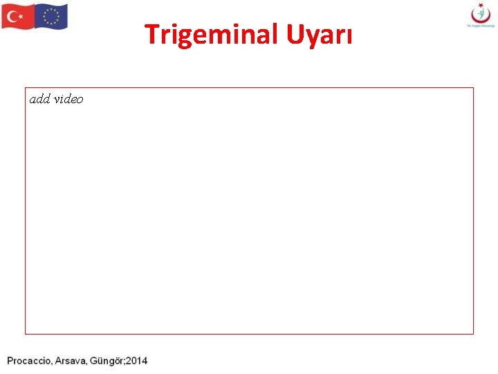 Trigeminal Uyarı add video Trigeminal Uyarı add video
