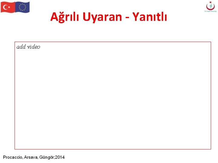 Ağrılı Uyaran - Yanıtlı add video Ağrılı Uyaran - Yanıtlı add video