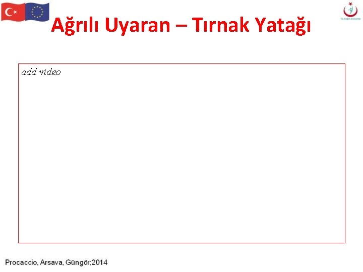 Ağrılı Uyaran – Tırnak Yatağı add video Ağrılı Uyaran – Tırnak Yatağı add video