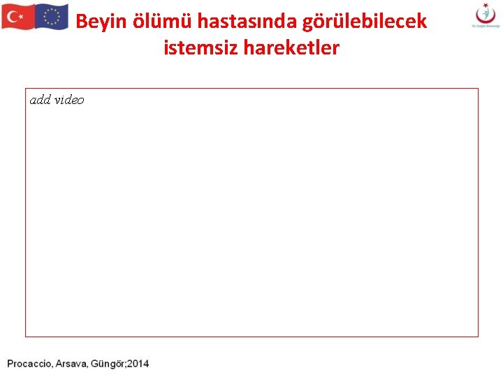 Beyin ölümü hastasında görülebilecek istemsiz hareketler add video Beyin ölümü hastasında görülebilecek istemsiz hareketler add video