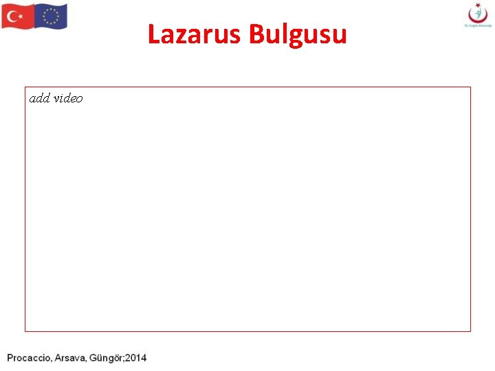 Lazarus Bulgusu add video Lazarus Bulgusu add video