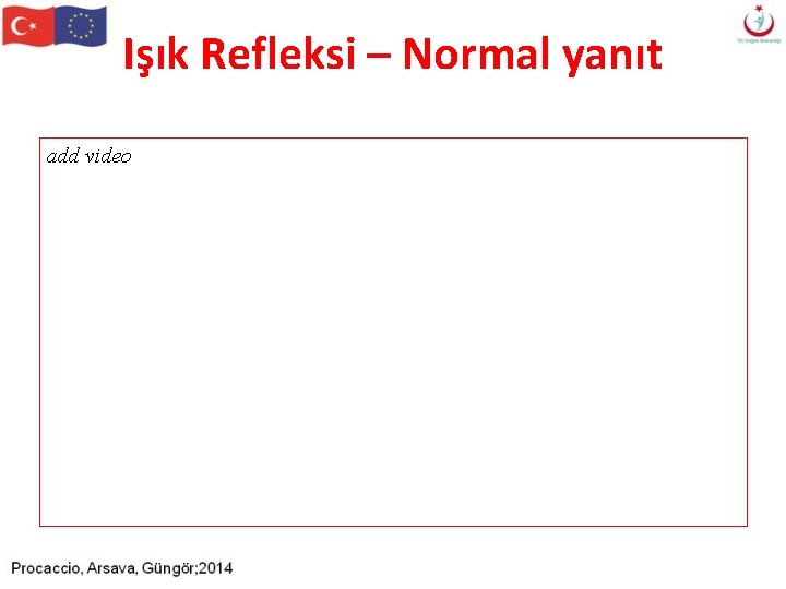 Işık Refleksi – Normal yanıt add video Işık Refleksi – Normal yanıt add video