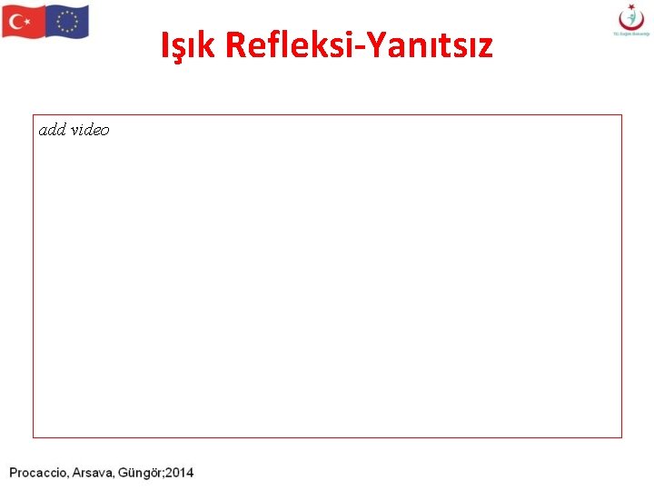 Işık Refleksi-Yanıtsız add video Işık Refleksi-Yanıtsız add video