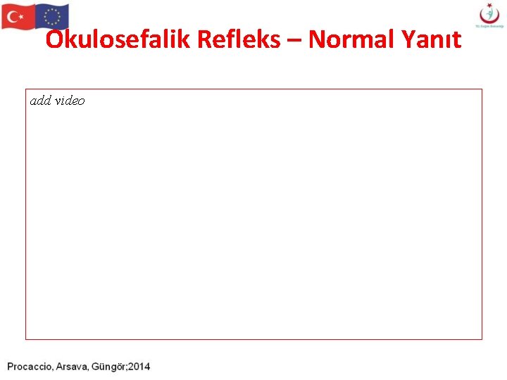Okulosefalik Refleks – Normal Yanıt add video Okulosefalik Refleks – Normal Yanıt add video