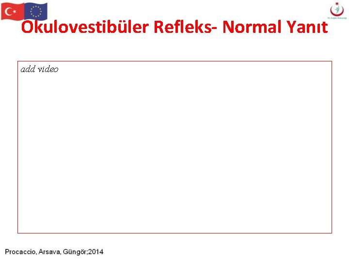 Okulovestibüler Refleks- Normal Yanıt add video Okulovestibüler Refleks- Normal Yanıt add video