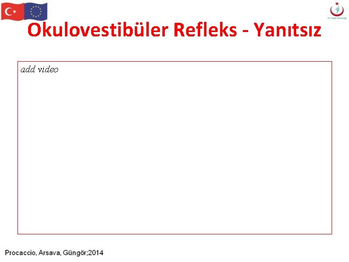 Okulovestibüler Refleks - Yanıtsız add video Okulovestibüler Refleks - Yanıtsız add video