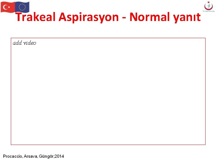 Trakeal Aspirasyon - Normal yanıt add video Trakeal Aspirasyon - Normal yanıt add video