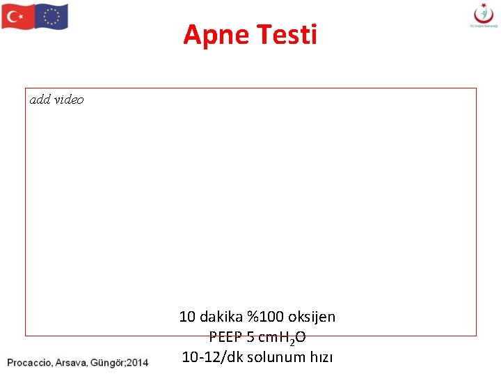 Apne Testi add video 10 dakika %100 oksijen PEEP 5 cm. H 2 O Apne Testi add video 10 dakika %100 oksijen PEEP 5 cm. H 2 O
