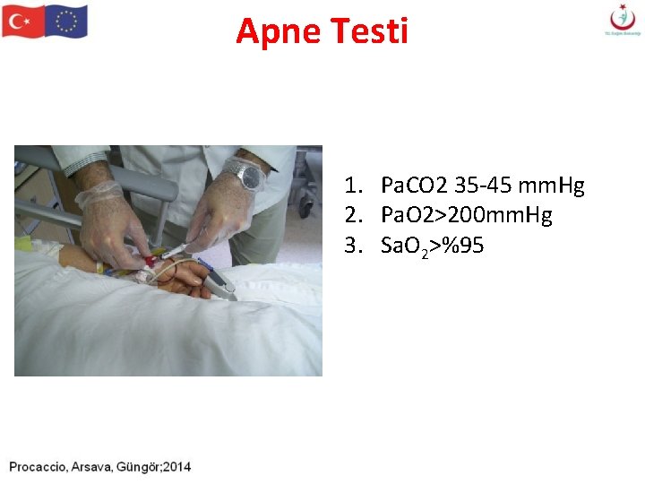 Apne Testi 1. Pa. CO 2 35 -45 mm. Hg 2. Pa. O 2>200 Apne Testi 1. Pa. CO 2 35 -45 mm. Hg 2. Pa. O 2>200