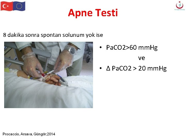 Apne Testi 8 dakika sonra spontan solunum yok ise • Pa. CO 2>60 mm. Apne Testi 8 dakika sonra spontan solunum yok ise • Pa. CO 2>60 mm.
