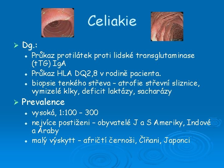 Celiakie Ø Dg. : l l l Ø Průkaz protilátek proti lidské transglutaminase (t.