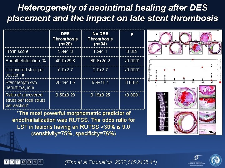 Heterogeneity of neointimal healing after DES placement and the impact on late stent thrombosis