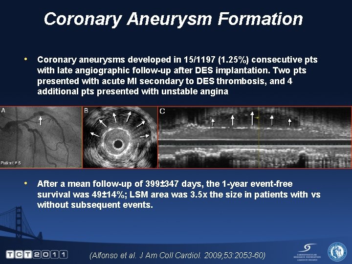 Coronary Aneurysm Formation • Coronary aneurysms developed in 15/1197 (1. 25%) consecutive pts with