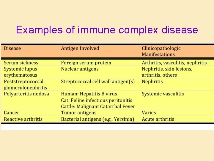 Examples of immune complex disease 