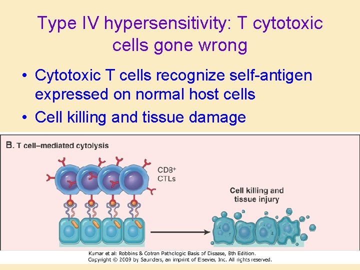 Type IV hypersensitivity: T cytotoxic cells gone wrong • Cytotoxic T cells recognize self-antigen