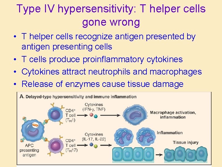 Type IV hypersensitivity: T helper cells gone wrong • T helper cells recognize antigen