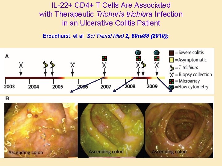 IL-22+ CD 4+ T Cells Are Associated with Therapeutic Trichuris trichiura Infection in an