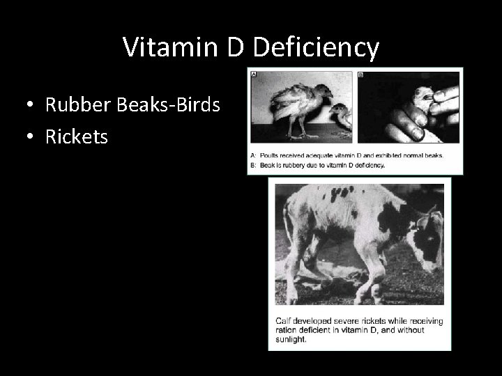 Vitamin D Deficiency • Rubber Beaks-Birds • Rickets 