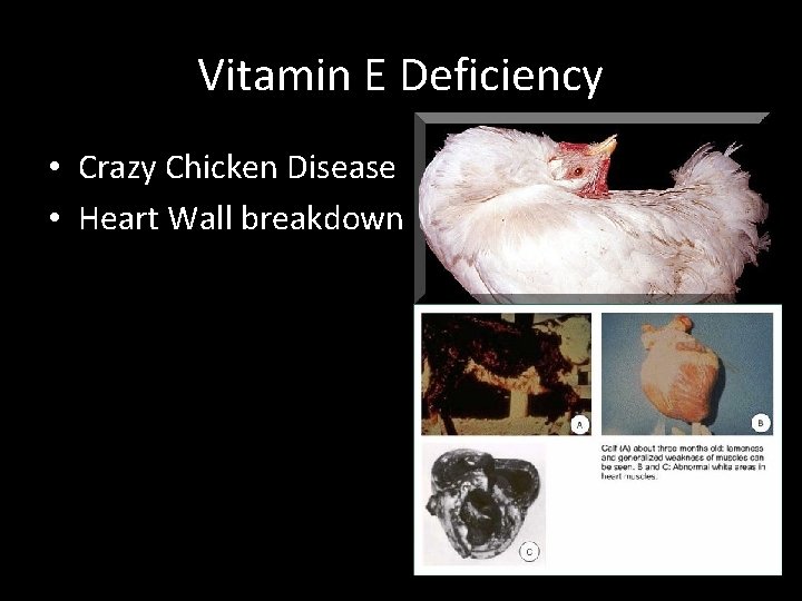 Vitamin E Deficiency • Crazy Chicken Disease • Heart Wall breakdown 