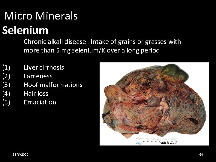 Micro Minerals Selenium (1) (2) (3) (4) (5) Chronic alkali disease--Intake of grains or