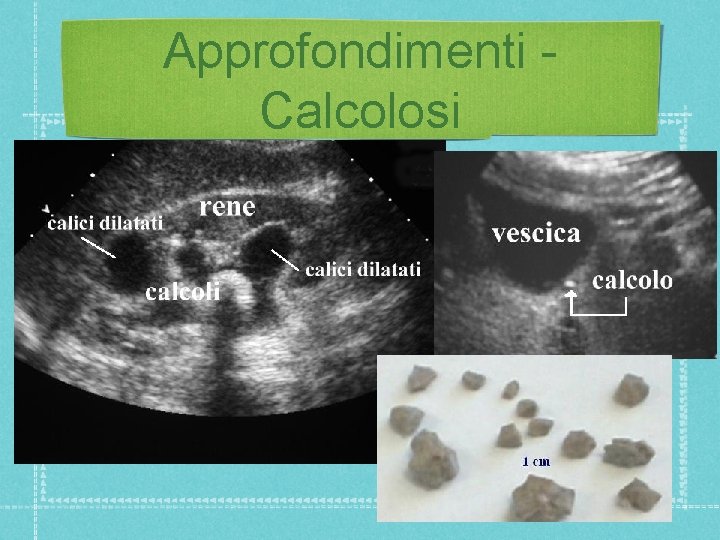 Approfondimenti Calcolosi 