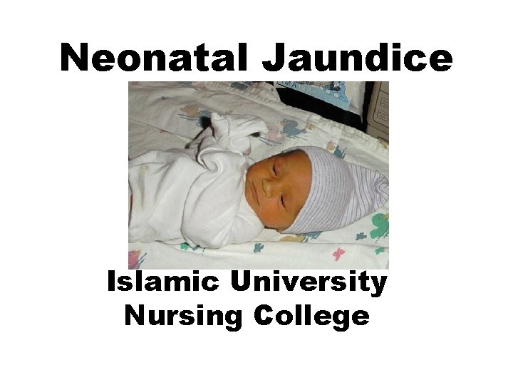 Neonatal Jaundice Islamic University Nursing College 