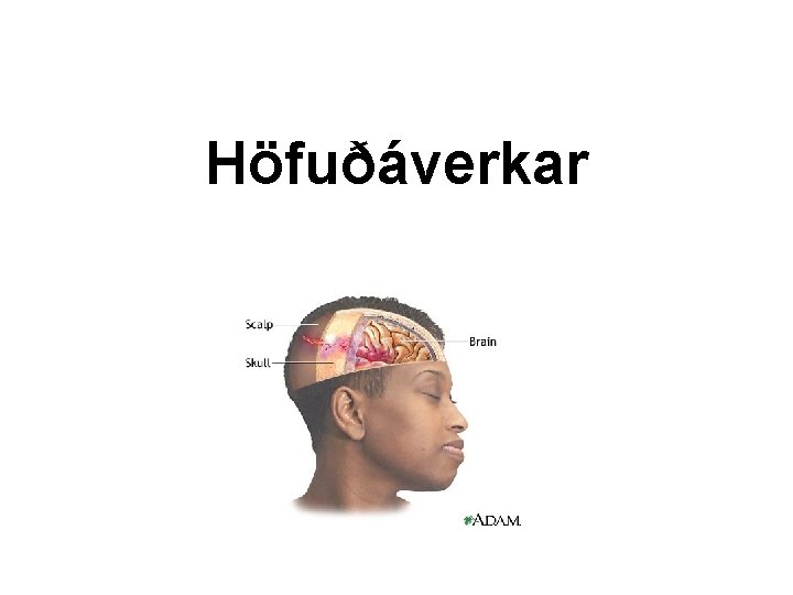 Höfuðáverkar 