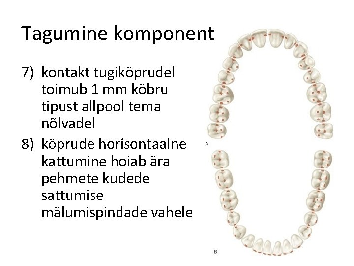 Tagumine komponent 7) kontakt tugiköprudel toimub 1 mm köbru tipust allpool tema nõlvadel 8)