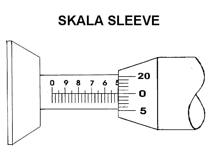 SKALA SLEEVE 