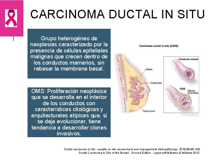 CARCINOMA DUCTAL IN SITU Grupo heterogéneo de neoplasias caracterizado por la presencia de células