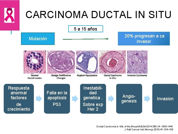 CARCINOMA DUCTAL IN SITU 5 a 15 años 20% progresan a ca invasor Mutación