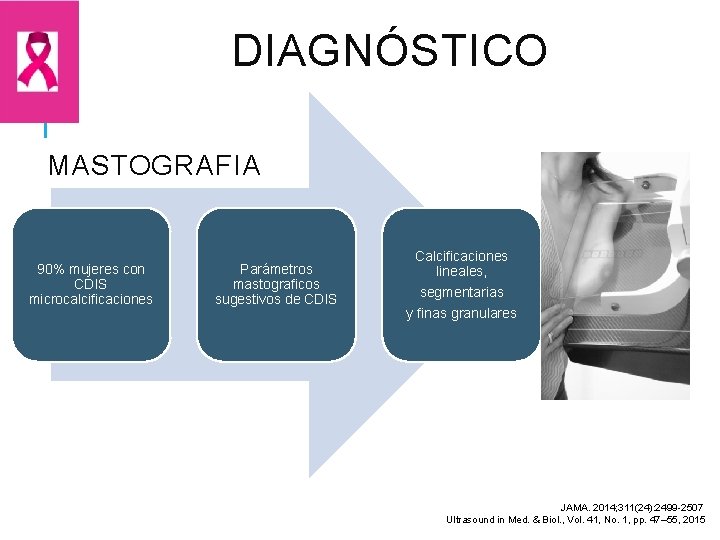 DIAGNÓSTICO MASTOGRAFIA 90% mujeres con CDIS microcalcificaciones Parámetros mastograficos sugestivos de CDIS Calcificaciones lineales,