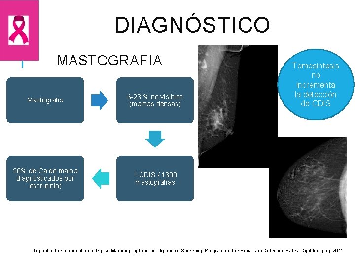 DIAGNÓSTICO MASTOGRAFIA Mastografía 6 -23 % no visibles (mamas densas) 20% de Ca de