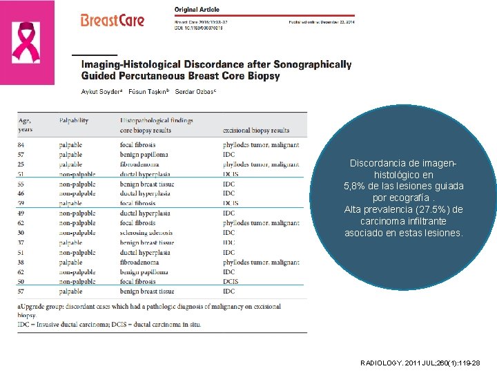 Discordancia de imagenhistológico en 5, 8% de las lesiones guiada por ecografía. Alta prevalencia