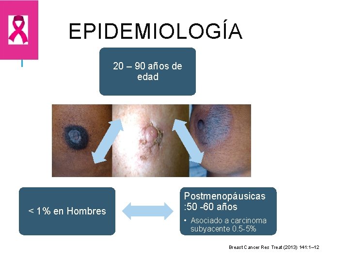 EPIDEMIOLOGÍA 20 – 90 años de edad < 1% en Hombres Postmenopáusicas : 50