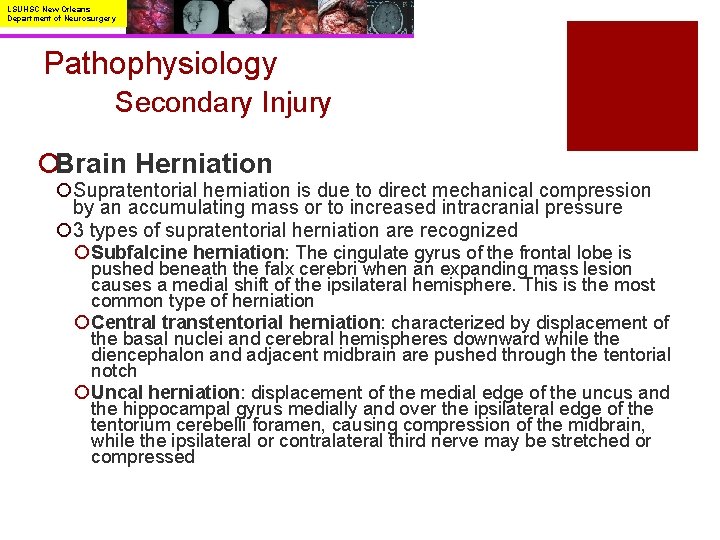 LSUHSC New Orleans Department of Neurosurgery Pathophysiology Secondary Injury ¡Brain Herniation ¡Supratentorial herniation is