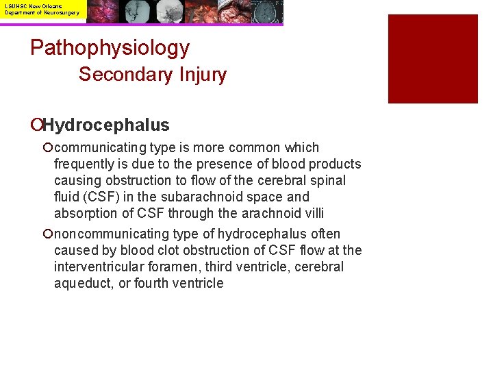 LSUHSC New Orleans Department of Neurosurgery Pathophysiology Secondary Injury ¡Hydrocephalus ¡communicating type is more
