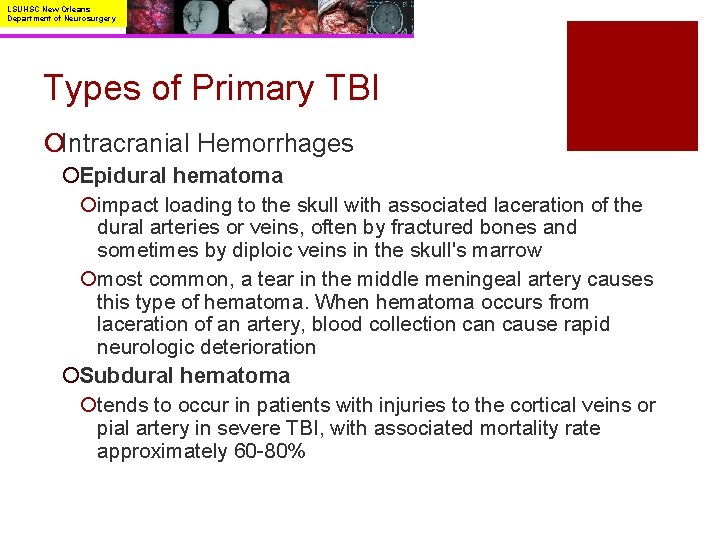 LSUHSC New Orleans Department of Neurosurgery Types of Primary TBI ¡Intracranial Hemorrhages ¡Epidural hematoma