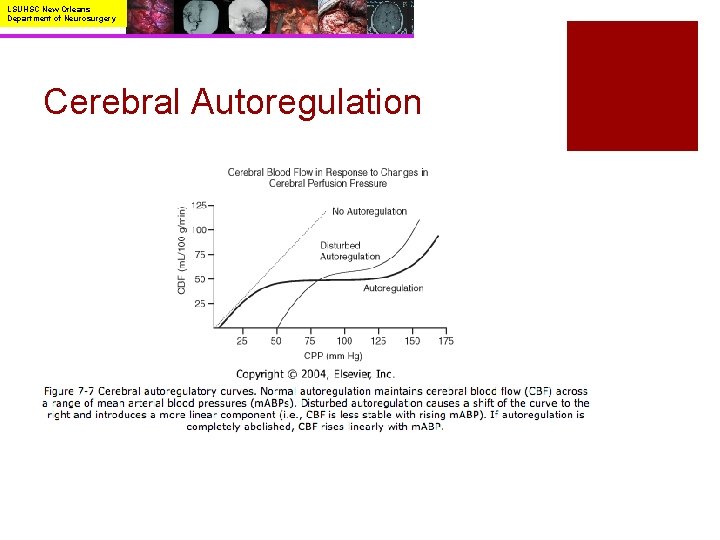 LSUHSC New Orleans Department of Neurosurgery Cerebral Autoregulation 