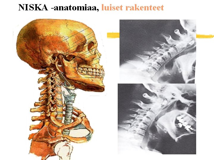 NISKA -anatomiaa, luiset rakenteet 